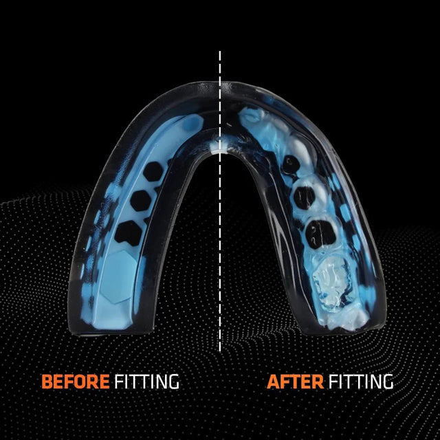 Shock Doctor | Gel Max Power | Maximum Protection Sports Mouthguard