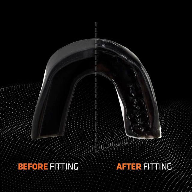 Shock Doctor | v1.5 | Basic Sports Mouthguard
